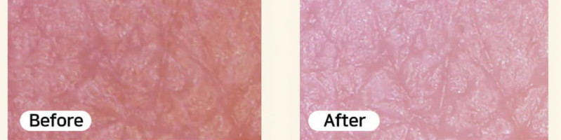 eye2in�V�~���ь��P�A ���̒e��5��t���Z�b�g���T�C�g